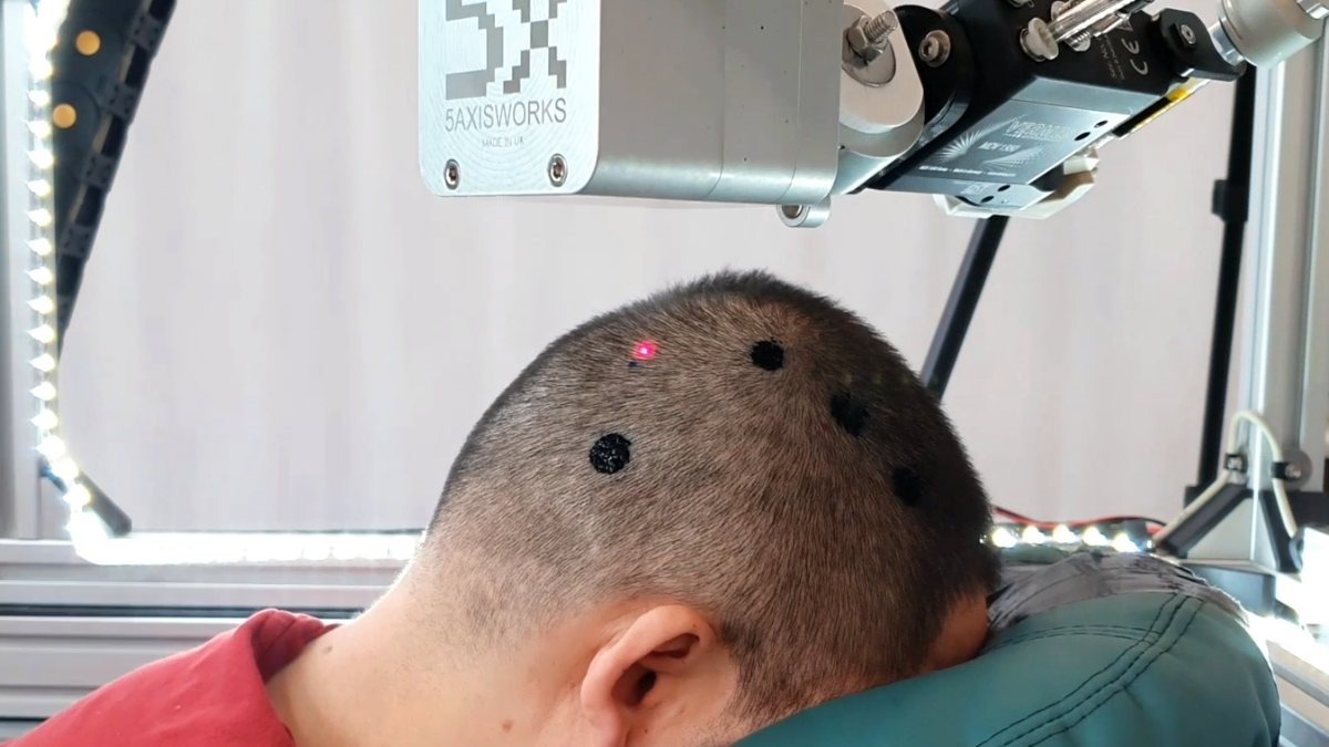 Il tatuaggio elettronico pronto a cambiare le regole dell’EEG, e non solo